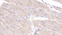 DAB staining on IHC-P; Samples: Human Cardiac Muscle Tissue;  Primary Ab: 40µg/ml Mouse Anti-Human CTGF Antibody Second Ab: 2µg/mL HRP-Linked Caprine Anti-Mouse IgG Polyclonal Antibody 