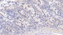 DAB staining on IHC-P; Samples: Human Small intestine Tissue;  Primary Ab: 20µg/ml Mouse Anti-Human IL17 Antibody Second Ab: 2µg/mL HRP-Linked Caprine Anti-Mouse IgG Polyclonal Antibody 