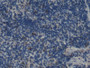 DAB staining on IHC-P; Samples: Mouse Spleen Tissue;  Primary Ab: 20µg/ml Mouse Anti-Mouse IL2 Antib
