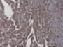 DAB staining on IHC-P; Samples: Rat Cardiac Muscle Tissue; Primary Ab: 20µg/ml Mouse Anti-Rat IL6 Antibody Second Ab: 2µg/mL HRP-Linked Caprine Anti-Mouse IgG Polyclonal Antibody