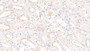 DAB staining on IHC-P; Samples: Human Kidney Tissue;  Primary Ab: 20µg/ml Mouse Anti-Human IL9 Antibody Second Ab: 2µg/mL HRP-Linked Caprine Anti-Mouse IgG Polyclonal Antibody 