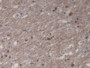 DAB staining on IHC-P; Samples: Human Cerebrum Tissue)