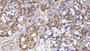 DAB staining on IHC-P; Samples: Human Stomach Tissue; Primary Ab: 10µg/ml Mouse Anti-Human IFNb Antibody Second Ab: 2µg/mL HRP-Linked Caprine Anti-Mouse IgG Polyclonal Antibody