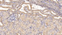 DAB staining on IHC-P; Samples: Human Kidney Tissue; Primary Ab: 10µg/ml Mouse Anti-Human b2M Antibody Second Ab: 2µg/mL HRP-Linked Caprine Anti-Mouse IgG Polyclonal Antibody