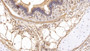 DAB staining on IHC-P; Samples: Human Lung Tissue; Primary Ab: 10µg/ml Mouse Anti-Human b2M Antibody Second Ab: 2µg/mL HRP-Linked Caprine Anti-Mouse IgG Polyclonal Antibody