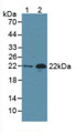 Western Blot; Sample: Lane1: Human Serum; Lane2: Rat Heart Tissue.