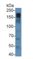 Western Blot; Sample: Human Hela cell lysate; ; Primary Ab: 6µg/ml Mouse Anti-Human EGFR Antibody; Second Ab: 0.2µg/mL HRP-Linked Caprine Anti-Mouse IgG Polyclonal Antibody;