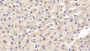 DAB staining on IHC-P; Samples: Human Stomach Tissue;  Primary Ab: 10µg/ml Mouse Anti-Human HIF1a Antibody Second Ab: 2µg/mL HRP-Linked Caprine Anti-Mouse IgG Polyclonal Antibody 