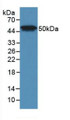 Western Blot; Sample: Recombinant LpPLA2, Human.