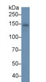 Western Blot; Sample: Human Serum; ; Primary Ab: 3µg/ml Mouse Anti-Human CP Antibody; Second Ab: 0.2µg/mL HRP-Linked Caprine Anti-Mouse IgG Polyclonal Antibody;