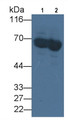 Albumin (ALB) Monoclonal Antibody, CAU29826