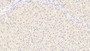 DAB staining on IHC-P; Samples: Human Liver Tissue; Primary Ab: 30µg/ml Mouse Anti-Human ALB Antibody Second Ab: 2µg/mL HRP-Linked Caprine Anti-Mouse IgG Polyclonal Antibody