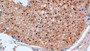 DAB staining on IHC-P; Samples: Human Liver Tissue;  Primary Ab: 10µg/ml Mouse Anti-Human Arg Antibody Second Ab: 2µg/mL HRP-Linked Caprine Anti-Mouse IgG Polyclonal Antibody 