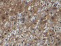 DAB staining on IHC-P; Samples: Human Liver Tissue; Primary Ab: 20µg/ml Mouse Anti-Human ARG Antibody Second Ab: 2µg/mL HRP-Linked Caprine Anti-Mouse IgG Polyclonal Antibody