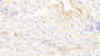 DAB staining on IHC-P; Samples: Human Placenta Tissue; Primary Ab: 10µg/ml Mouse Anti-Human FGb Antibody Second Ab: 2µg/mL HRP-Linked Caprine Anti-Mouse IgG Polyclonal Antibody