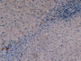 DAB staining on IHC-P; Samples: Human Liver Tissue; Primary Ab: 10µg/ml Mouse Anti-Human KRT19 Antibody Second Ab: 2µg/mL HRP-Linked Caprine Anti-Mouse IgG Polyclonal Antibody