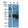 Western Blot; Sample: Lane1: Human Serum; Lane2: Human Urine; Lane3: Human SW480 cell lysate ; Primary Ab: 2µg/ml Mouse Anti-Human NGAL Antibody; Second Ab: 0.2µg/ml HRP-Linked Rabbit Anti-Mouse IgG Polyclonal Antibody;