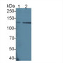 Western Blot; Sample: Lane1: Human Hela cell lysate; Lane2: Human MCF7 cell lysate Primary Ab: 3µg/ml Mouse Anti-Human EGFR2 Antibody Second Ab: 0.2µg/mL HRP-Linked Rabbit Anti-Mouse IgG Polyclonal Antibody