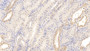 DAB staining on IHC-P; Samples: Human Kidney Tissue;  Primary Ab: 10µg/ml Mouse Anti-Human MIg Antibody Second Ab: 2µg/mL HRP-Linked Caprine Anti-Mouse IgG Polyclonal Antibody 