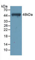 Western Blot; Sample: Recombinant TNNC1, Human.