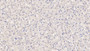 DAB staining on IHC-P; Samples: Human Liver Tissue;  Primary Ab: 30µg/ml Mouse Anti-Human ROS1 Antibody Second Ab: 2µg/mL HRP-Linked Caprine Anti-Mouse IgG Polyclonal Antibody 