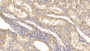 DAB staining on IHC-P; Samples: Human Kidney Tissue;  Primary Ab: 10µg/ml Mouse Anti-Human KPNa2 Antibody Second Ab: 2µg/mL HRP-Linked Caprine Anti-Mouse IgG Polyclonal Antibody 