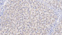 DAB staining on IHC-P; Samples: Human Liver Tissue; Primary Ab: 10µg/ml Mouse Anti-Human VDAC1 Antibody Second Ab: 2µg/mL HRP-Linked Caprine Anti-Mouse IgG Polyclonal Antibody