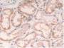 Figure. DAB staining on IHC-P; Samples: Human Kidney Tissue.