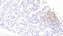 DAB staining on IHC-P; Samples: Rabbit Colon Tissue; Primary Ab: 20μg/ml Cavia Anti-Rabbit IL1RA Antibody Second Ab: 2µg/mL HRP-Linked Rabbit Anti-Cavia IgG Polyclonal Antibody