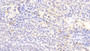 DAB staining on IHC-P; Samples: Rabbit Spleen Tissue;  Primary Ab: 20μg/ml Cavia Anti-Rabbit IL1RA Antibody Second Ab: 2µg/mL HRP-Linked Rabbit Anti-Cavia IgG Polyclonal Antibody 