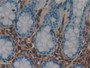 DAB staining on IHC-P; Samples: Human Rectum Tissue; Primary Ab: 20µg/ml Rabbit Anti-Human GAL1 Antibody Second Ab: 2µg/mL HRP-Linked Caprine Anti-Rabbit IgG Polyclonal Antibody