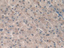 DAB staining on IHC-P; Samples: Human Liver Tissue; Primary Ab: 20µg/ml Rabbit Anti-Human CT Antibody Second Ab: 2µg/mL HRP-Linked Caprine Anti-Rabbit IgG Polyclonal Antibody