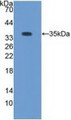 Western Blot; Sample: Recombinant PKCb1, Rabbit.