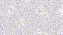 DAB staining on IHC-P; Samples: Mouse Kidney Tissue;  Primary Ab: 20μg/ml Rabbit Anti-Human SNCa Antibody Second Ab: 2µg/mL HRP-Linked Caprine Anti-Rabbit IgG Polyclonal Antibody 
