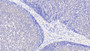 DAB staining on IHC-P; Samples: Human Lymph node Tissue; Primary Ab: 20μg/ml Rabbit Anti-Human ACAT1 Antibody Second Ab: 2µg/mL HRP-Linked Caprine Anti-Rabbit IgG Polyclonal Antibody