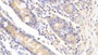 DAB staining on IHC-P; Samples: Human Small intestine Tissue;  Primary Ab: 20μg/ml Rabbit Anti-Human UBE2S Antibody Second Ab: 2µg/mL HRP-Linked Caprine Anti-Rabbit IgG Polyclonal Antibody 