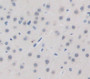 Leucine Rich Repeat Kinase 2 (Lrrk2) Polyclonal Antibody, Cat#CAU29998