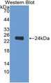 Interleukin 6 (IL6) Monoclonal Antibody, CAU30019