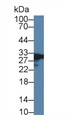 Cardiac Troponin I (cTnI) Monoclonal Antibody, CAU30041