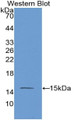 Mannose Associated Serine Protease 2 (MASP2) Monoclonal Antibody, CAU30064