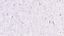 DAB staining on IHC-P; Samples: Human Cerebrum Tissue; Primary Ab: 40µg/ml Mouse Anti-Human AchE Antibody Second Ab: 2µg/mL HRP-Linked Caprine Anti-Mouse IgG Polyclonal Antibody