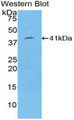 Cytokeratin 8 (CK8) Monoclonal Antibody, CAU30089