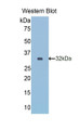 Reelin (RELN) Monoclonal Antibody, CAU30095