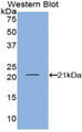 Interferon Gamma (IFNg) Polyclonal Antibody, CAU30131