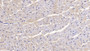 DAB staining on IHC-P; Samples: Human Cardiac Muscle Tissue;  Primary Ab: 10µg/ml Mouse Anti-Human SEMA5B Antibody Second Ab: 2µg/mL HRP-Linked Caprine Anti-Mouse IgG Polyclonal Antibody 