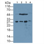Thymidine Kinase 1, Soluble (TK1) Monoclonal Antibody, CAU30150
