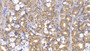 DAB staining on IHC-P; Samples: Human Stomach Tissue; Primary Ab: 10µg/ml Mouse Anti-Human TK1 Antibody Second Ab: 2µg/mL HRP-Linked Caprine Anti-Mouse IgG Polyclonal Antibody