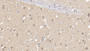 DAB staining on IHC-P; Samples: Human Cerebrum Tissue;  Primary Ab: 20µg/ml   Rabbit Anti-Human TGM1 Antibody Second Ab: 2µg/mL HRP-Linked Caprine Anti-Rabbit IgG Polyclonal Antibody 