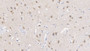 DAB staining on IHC-P; Samples: Human Cerebrum Tissue;  Primary Ab: 20µg/ml   Rabbit Anti-Human GS Antibody Second Ab: 2µg/mL HRP-Linked Caprine Anti-Rabbit IgG Polyclonal Antibody 