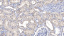 DAB staining on IHC-P; Samples: Human Kidney Tissue;  Primary Ab: 20µg/ml   Rabbit Anti-Human TAN1 Antibody Second Ab: 2µg/mL HRP-Linked Caprine Anti-Rabbit IgG Polyclonal Antibody 